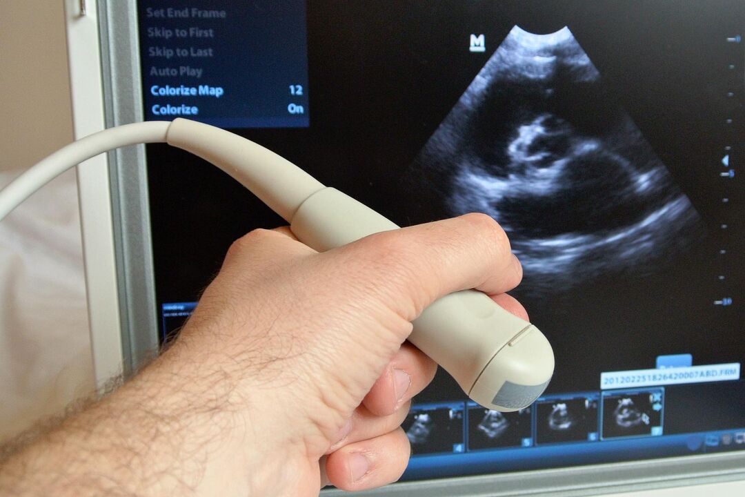 Ultrasound bakal ngabantosan diagnosis prostatitis kongestif di lalaki